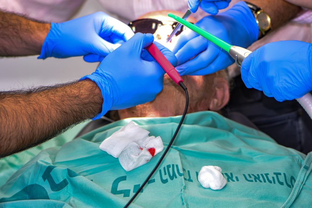 l'anesthésie générale en dentisterie